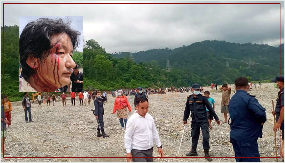सर्दुखोलामा झडपः ‘आक्रमणमा संलग्न’ लाई दुई ‘केस’ !