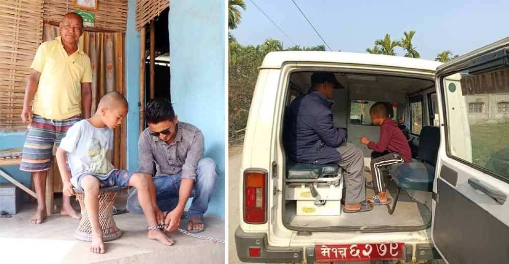 अन्ततः साङ्लोमा बाँधिएका ९ वर्षीय बालकको उपचार हुने