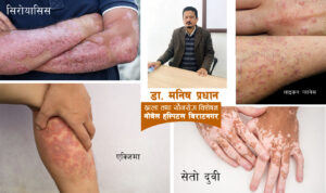 तपाईको छाला त ठीक छ ? सही उपचार नपाउँदा थप जोखिम बढ्ला है !