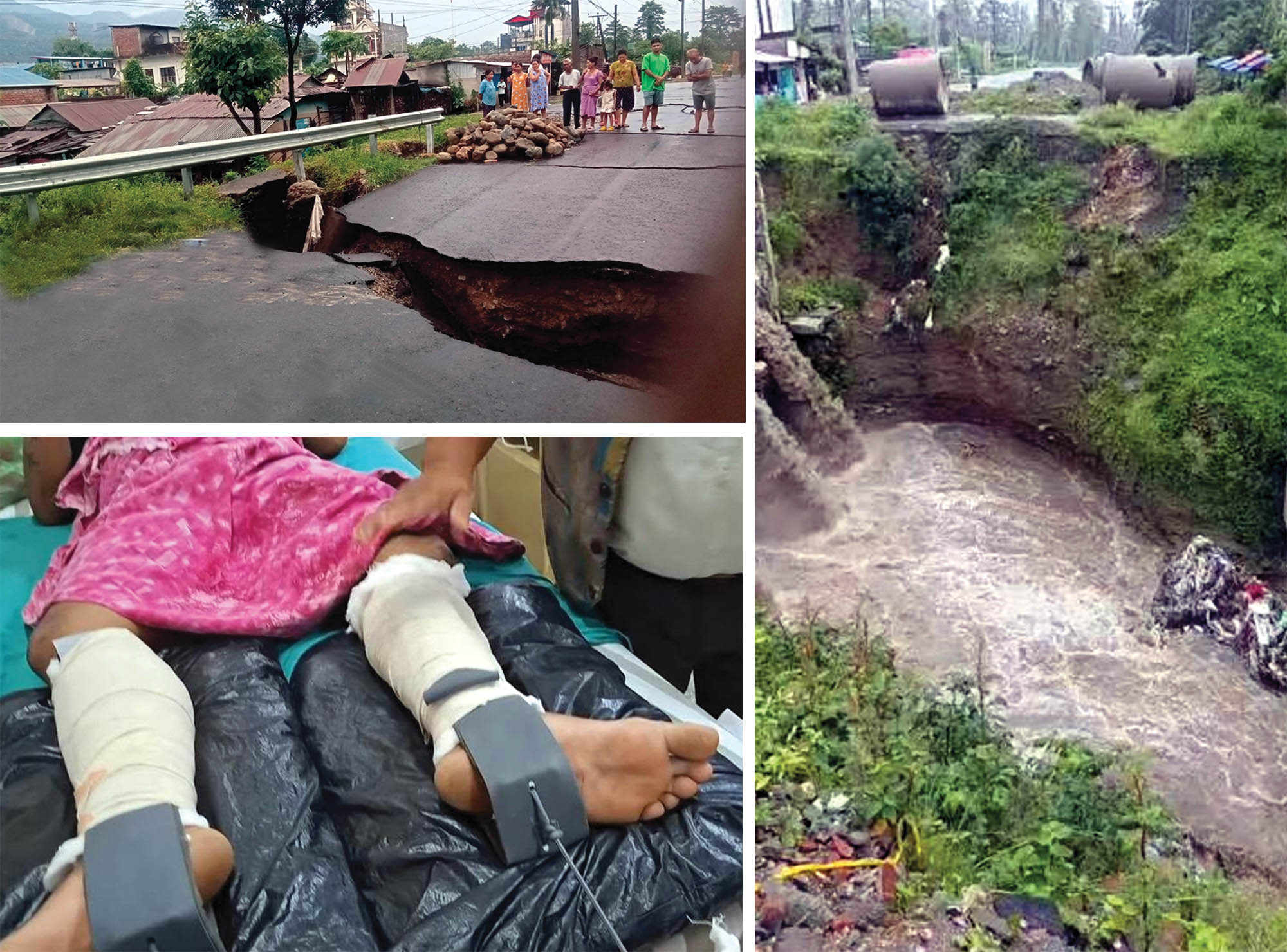 धरानमा ज्यान गयो, खुट्टा भाँच्चियो तर बनेन कल्भर्ट