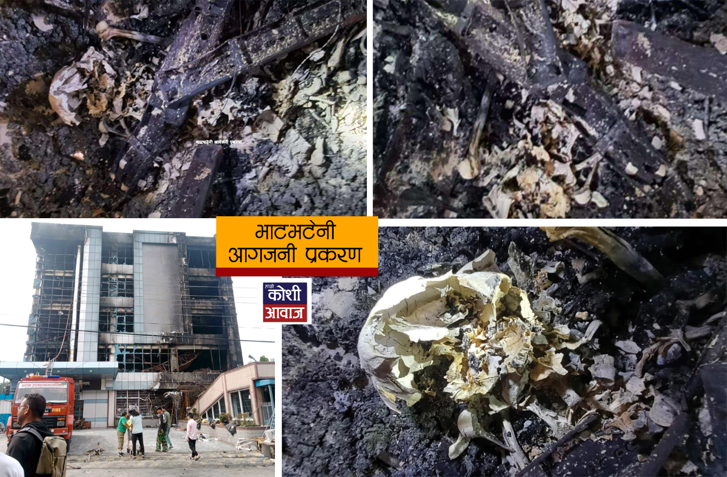 धरानमा भेटिएका मानव खप्पर, दाँत र हडडीको अवशेषसहितको मानव कङकाल रहस्यमै